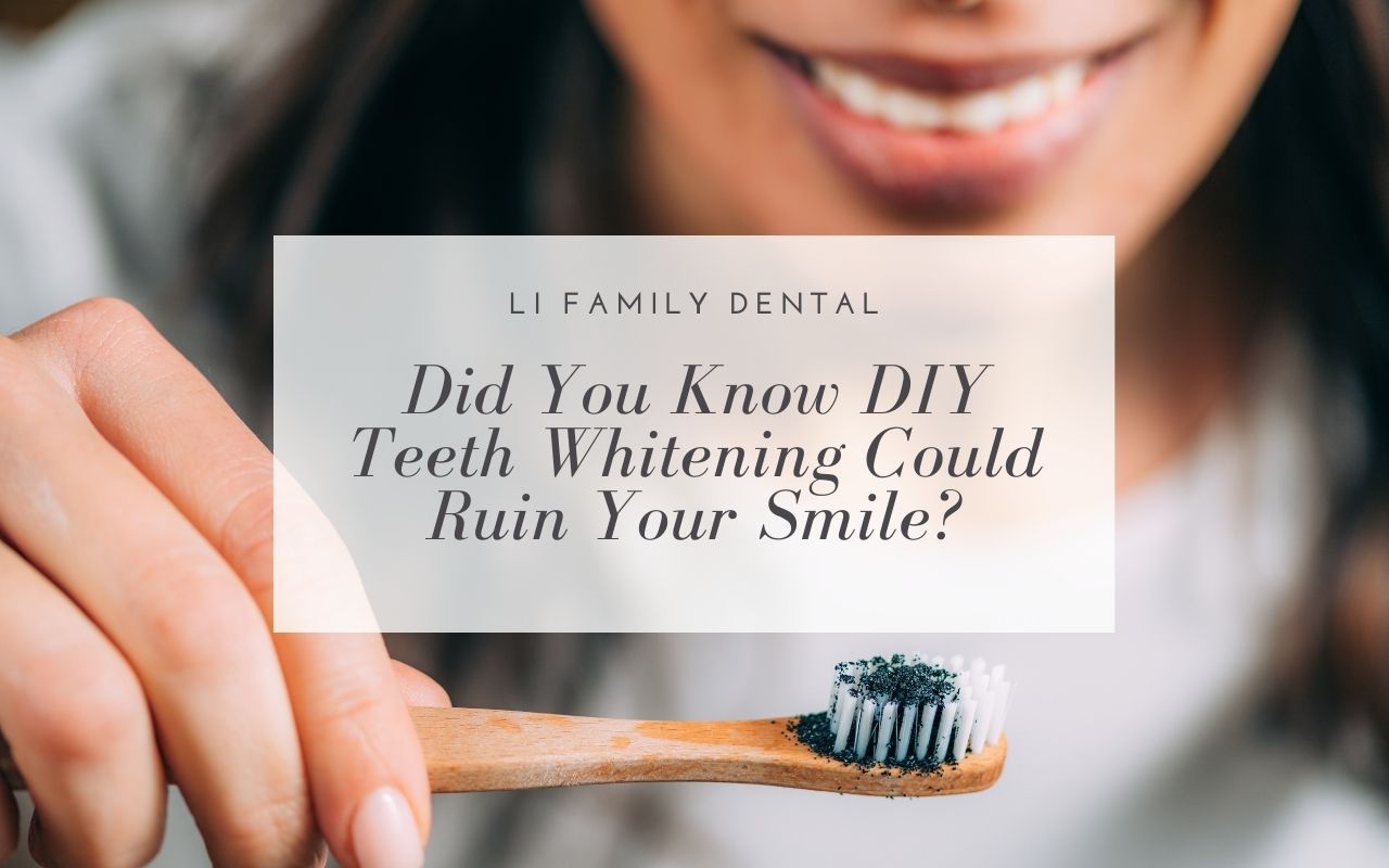 DIY Teeth Whitening Could Ruin Your Smile Li Family Dental
