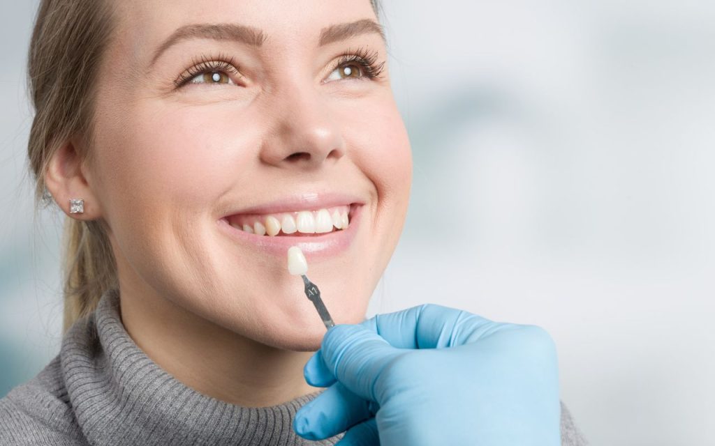 pros-and-cons-of-teeth-veneers