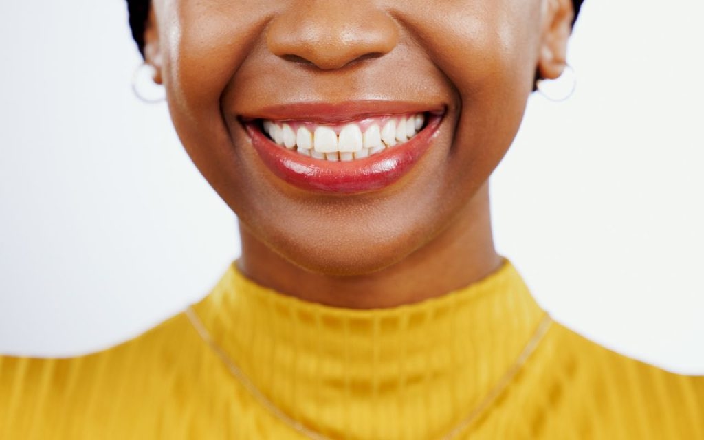 veneers-vs-bonding-which-is-better