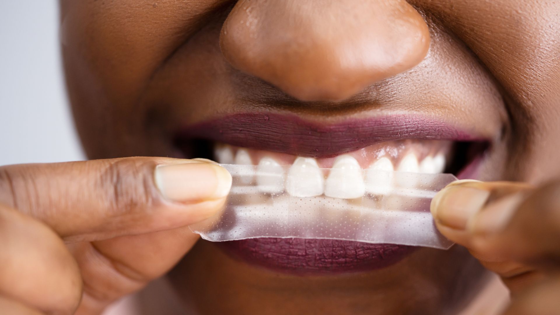 A person applying a teeth whitening strip to their upper teeth, with their lips parted and hands holding the strip in place.