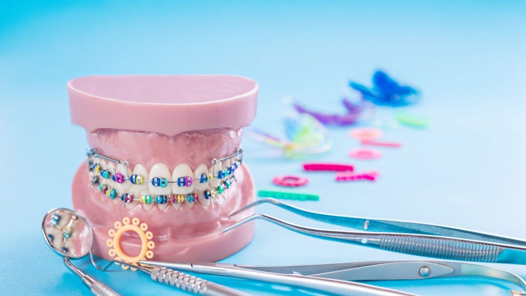 A dental model with colorful braces is displayed next to orthodontic tools and various brackets on a blue background.