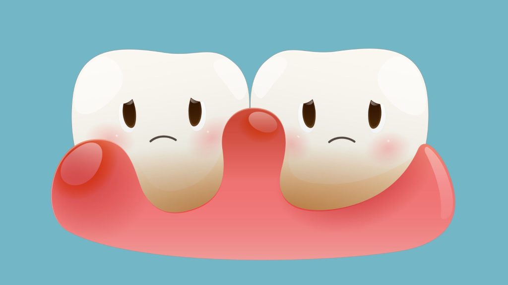 Dental specialties - periodontics. Illustration of two sad cartoon teeth surrounded by red, swollen gums, suggesting gum inflammation or gingivitis, on a blue background.