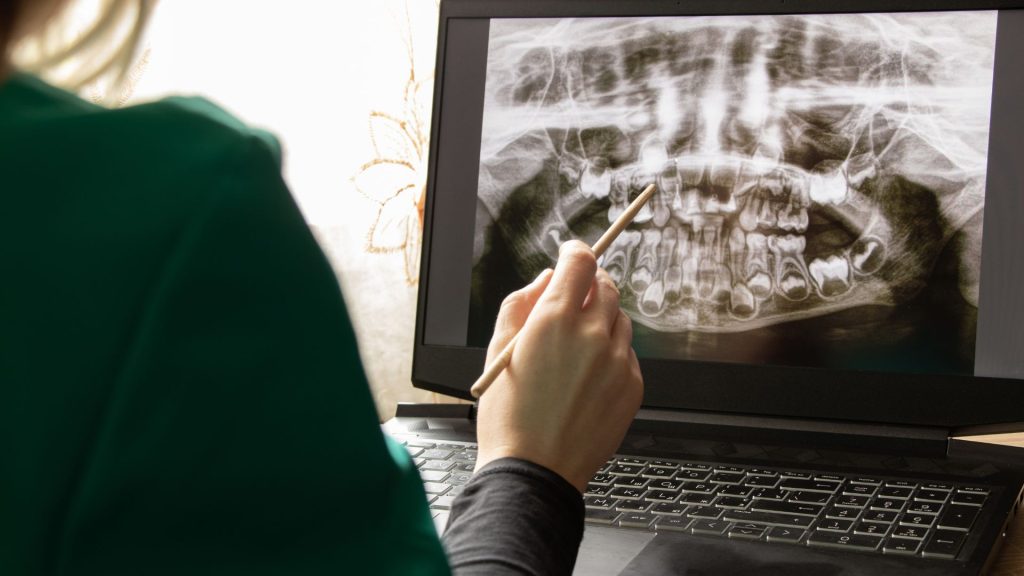 A person points at a dental X-ray image displayed on a laptop screen with a pen.