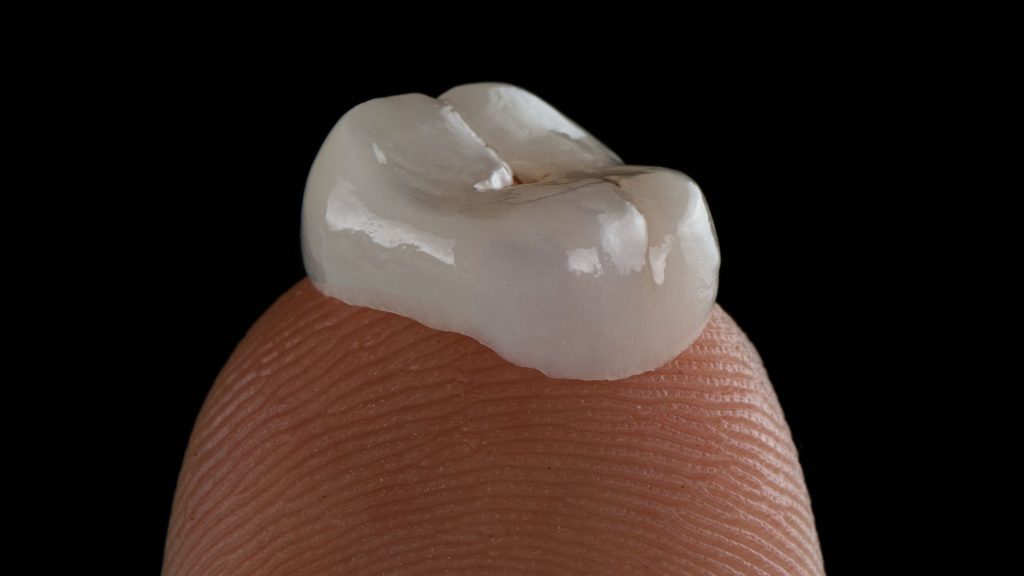 A dental crown resting on the tip of a finger against a black background.