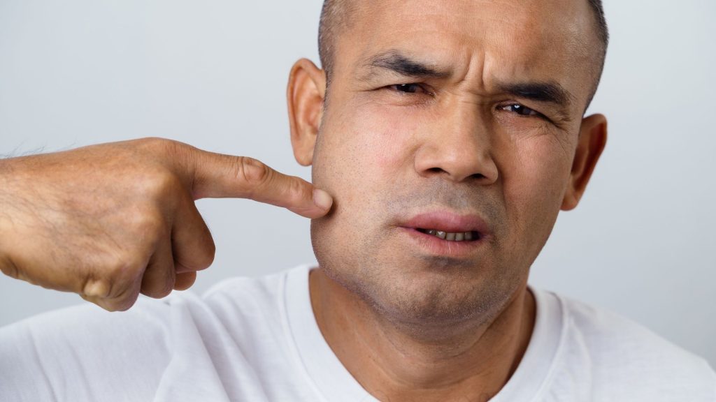 A man with a concerned expression points to his swollen cheek, possibly indicating pain or discomfort in the jaw area.