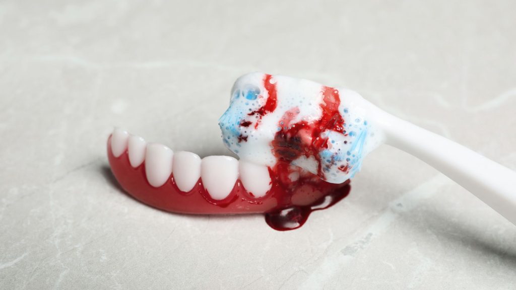 A toothbrush with toothpaste is brushing a set of artificial teeth with fake blood, simulating bleeding gums on a light-colored surface.