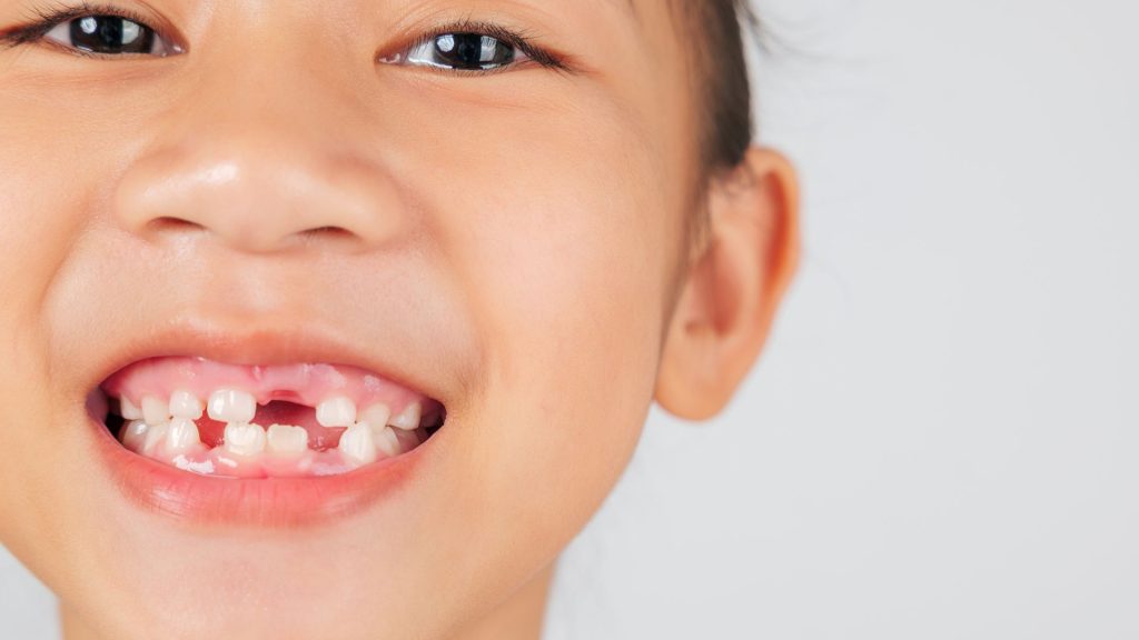 Close-up of a smiling child with missing front teeth, showing how children’s teeth erupt and fall out as new adult teeth grow in.