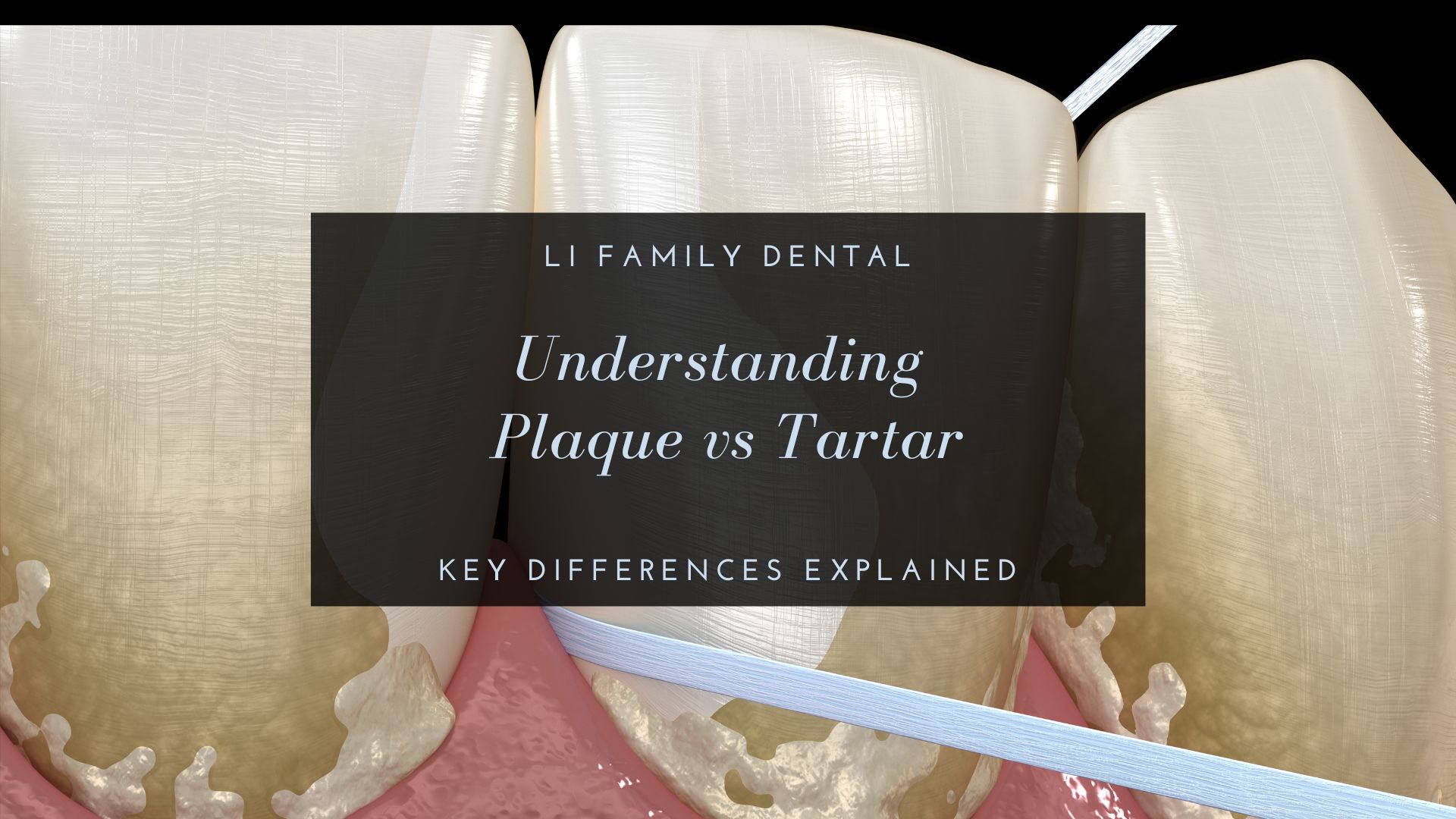Close-up illustration of teeth with visible plaque and tartar build-up, and dental floss between teeth; text overlay discusses plaque vs tartar differences.