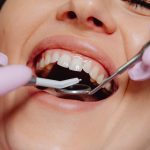Close-up of a person receiving a dental checkup, with gloved hands holding dental tools inside their mouth.